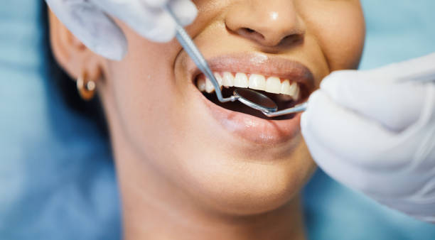 Best Walk-In Emergency Dentist in Hilltop, SC