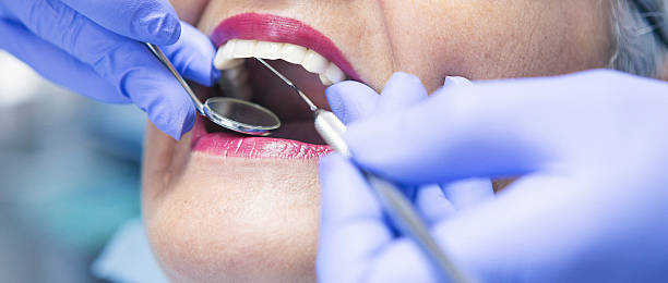 Best Emergency Wisdom Teeth Removal in Hilltop, SC